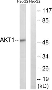 Western blot analysis of lysates from HepG2 cells, treated with Serum 30% 30' using Anti-Akt Antibody. The right hand lane represents a negative control, where the antibody is blocked by the immunising peptide