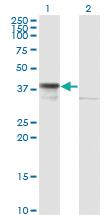 Anti-DNAJB6 Mouse Monoclonal Antibody [clone: 2D12-B9]