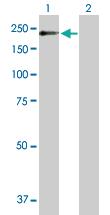 Anti-POGZ Mouse Polyclonal Antibody