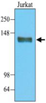 Anti-PTPRC Mouse Monoclonal Antibody [clone: 3G4]