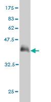 Anti-PHF21A Mouse Monoclonal Antibody [clone: 5A6]