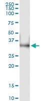 Anti-LDHA Polyclonal Antibody Pair