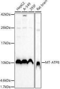 Western blot analysis of extracts of various cell lines, using Anti-ATP8 Antibody (A93022) at 1:1,000 dilution. The secondary antibody was Goat Anti-Rabbit IgG H&L Antibody (HRP) at 1:10,000 dilution.