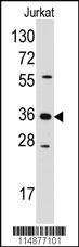 Anti-AKR1B1 Rabbit Polyclonal Antibody