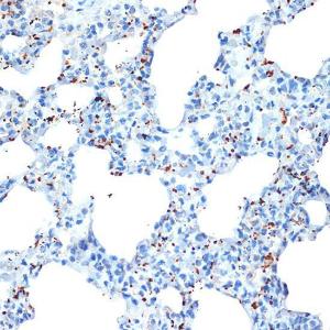 Immunohistochemistry analysis of paraffin-embedded rat lung using Anti-PF4 Antibody [ARC2076] (A307846) at a dilution of 1:100 (40X lens). Perform microwave antigen retrieval with 10 mM Tris/EDTA buffer pH 9.0 before commencing with IHC staining protocol