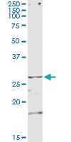 Anti-TSSK3 Mouse Monoclonal Antibody [clone: 6H4]