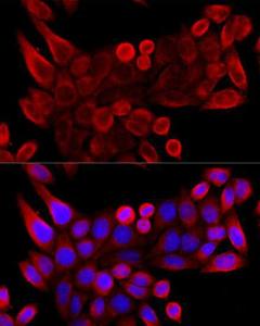 Immunofluorescence analysis of HeLa cells using Anti-VDAC3 Antibody (A8647) at a dilution of 1:100 (40X lens). DAPI was used to stain the cell nuclei (blue)