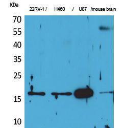 Western blot analysis of 22RV H460, U87, mouse brain cells using Anti-APLN Antibody