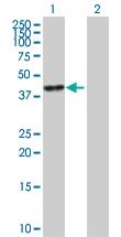 Anti-CA6 Mouse Polyclonal Antibody