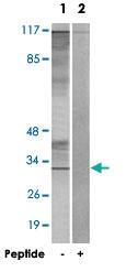 Anti-CIB3 Rabbit Polyclonal Antibody