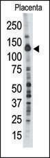 Anti-PTPN21 Rabbit Polyclonal Antibody (PE (Phycoerythrin))