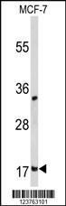 Anti-DSTN Rabbit Polyclonal Antibody (APC (Allophycocyanin))