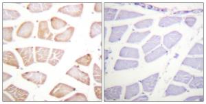 Immunohistochemical analysis of paraffin-embedded human skeletal muscle tissue using Anti-Akt Antibody. The right hand panel represents a negative control, where the antibody was pre-incubated with the immunising peptide