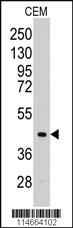 Anti-ALDOC Rabbit Polyclonal Antibody