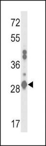 Anti-GSTA2 Rabbit Polyclonal Antibody (APC (Allophycocyanin))