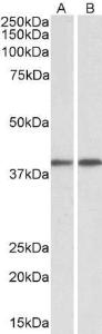 Antibody anti-GNAQ 100 µg