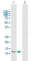 Anti-FABP5 Mouse Polyclonal Antibody