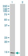 Anti-FABP5 Mouse Polyclonal Antibody