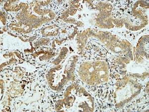 Anti-pan Cadherin Rabbit Polyclonal Antibody