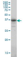 Anti-CA8 Mouse Monoclonal Antibody [clone: 1F7]