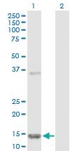 Anti-FABP5 Rabbit Polyclonal Antibody