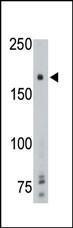 Anti-PTP gamma Rabbit Polyclonal Antibody (Biotin)