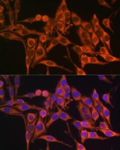 Immunofluorescence analysis of HeLa cells using Anti-ATP8 Antibody (A93022) at a dilution of 1:100. DAPI was used to stain the cell nuclei (blue).