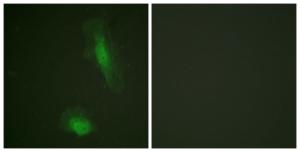 Immunofluorescence analysis of HeLa cells using Anti-Akt Antibody. The right hand panel represents a negative control, where the antibody was pre-incubated with the immunising peptide