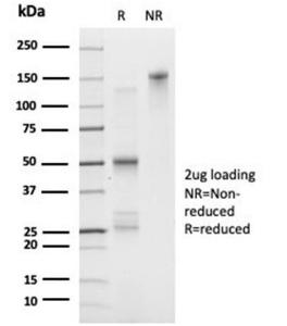 SDS-PAGE analysis of Anti-FOXL1 Antibody [PCRP-FOXL1-1F8] under non-reduced and reduced conditions; showing intact IgG and intact heavy and light chains, respectively. SDS-PAGE analysis confirms the integrity and purity of the antibody.