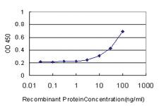 Anti-CA8 Mouse Monoclonal Antibody [clone: 1F7]