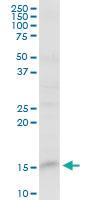 Anti-FABP5 Rabbit Polyclonal Antibody