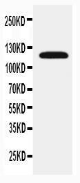 Anti-SLC12A1 Rabbit Polyclonal Antibody