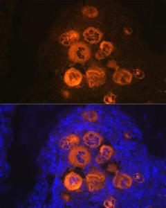 Immunofluorescence analysis of rat bone marrow using Anti-PF4 Antibody [ARC2076] (A307846) at a dilution of 1:100 (40X lens). DAPI was used to stain the cell nuclei (blue)