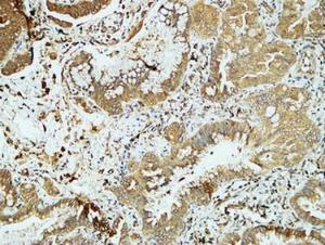 Anti-pan Cadherin Rabbit Polyclonal Antibody