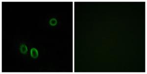 Immunofluorescence analysis of A549 cells using Anti-OR51E1 Antibody. The right hand panel represents a negative control, where the antibody was pre-incubated with the immunising peptide.