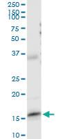 Anti-FABP5 Rabbit Polyclonal Antibody