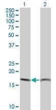 Anti-PTH Mouse Monoclonal Antibody [clone: 3E7]