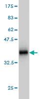 Anti-AKT3 Mouse Monoclonal Antibody [clone: 4C1]