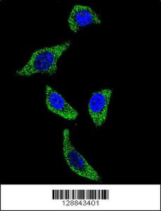 Anti-TNFRSF1A Rabbit Polyclonal Antibody (Biotin)