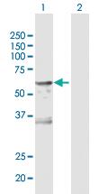 Anti-CA9 Rabbit Polyclonal Antibody