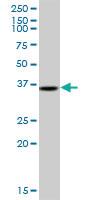 Anti-TRA2A Mouse Polyclonal Antibody