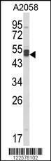 Anti-AGPAT3 Rabbit Polyclonal Antibody (HRP (Horseradish Peroxidase))