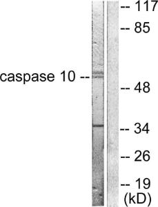 Western blot analysis of lysates from HeLa cells using Anti-Caspase 10 Antibody. The right hand lane represents a negative control, where the antibody is blocked by the immunising peptide