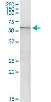 Anti-CA9 Rabbit Polyclonal Antibody