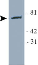 Anti-YAP1 Polyclonal Antibody