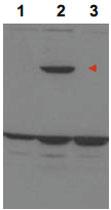 Anti-PPP1R13B Rabbit Polyclonal Antibody