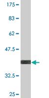 Anti-CDR2 Mouse Monoclonal Antibody [clone: 1F8]