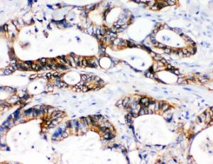 Anti-NKCC1 Rabbit Polyclonal Antibody