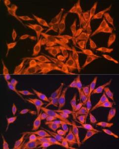 Immunofluorescence analysis of HeLa cells using Anti-ATP8 Antibody (A93022) at a dilution of 1:100. DAPI was used to stain the cell nuclei (blue).