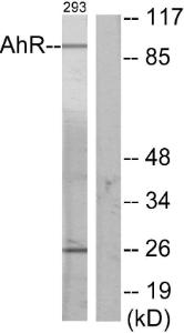 Western blot analysis of lysates from 293 cells using Anti-AhR Antibody. The right hand lane represents a negative control, where the antibody is blocked by the immunising peptide.